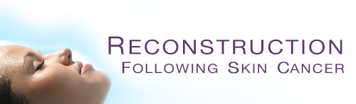 reconstruction following skin cancer
