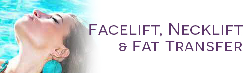 facelift