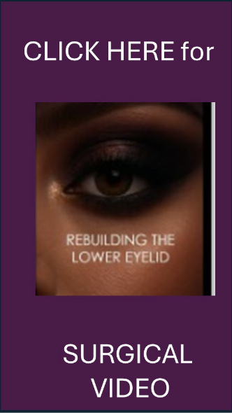 San Diego | La Jolla | Carmel Valley | Del Mar | Encinitas | Plastic Surgery | Cosmetic Surgery | Eyelid Expert | Eyelid Surgery | Ptosis | Oculoplastic Surgery | Browlift | Blepharoplasty | Oculoplastic Surgery | Facial Rejuvenation | Top Plastic Surgeon